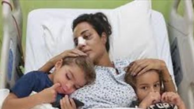 Photo of نادين نسيب نجيم تعافت والجروح اختفت عن وجهها؟ (صورة)