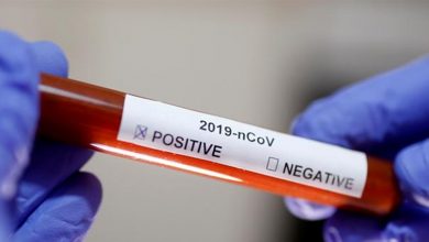 Photo of السعودي يعلن إصابته بالفيروس ودعا المخالطين الى اجراء الـPCR