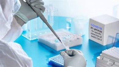 Photo of مستشفى الهمشري أجرى فحوص PCR لمخالطين