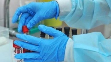 Photo of فحوص PCR في مستشفى سيدة السلام القبيات