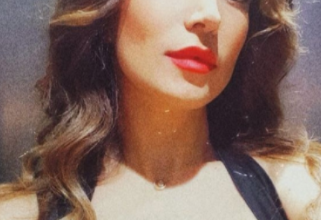 Photo of بالصور – ممثلة سوريّة شابة مصابة بجروح عميقة