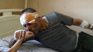 Photo of سوزي” الطفلة الفلسطينية التي نجت من ضربة إسرائيلية قتلت أمها وإخوتها الأربعة.. هذه قصتها (صور)