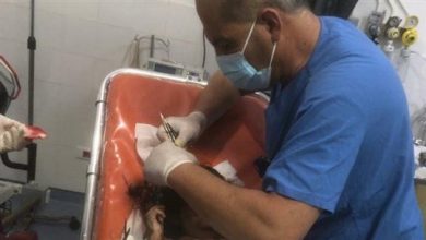 Photo of العناية الإلهية تنقذ مواطناً وحفيده بعدما هاجمهما كلب في منزلهما