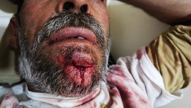 Photo of اعتداء همجي من عناصر أمن الدولة على والد الطفل الذي استشهد في حرائق عكار