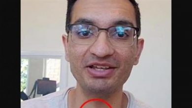 Photo of صدمة على تيك توك.. اكتشف إصابته بالسرطان من مشهد (صور)