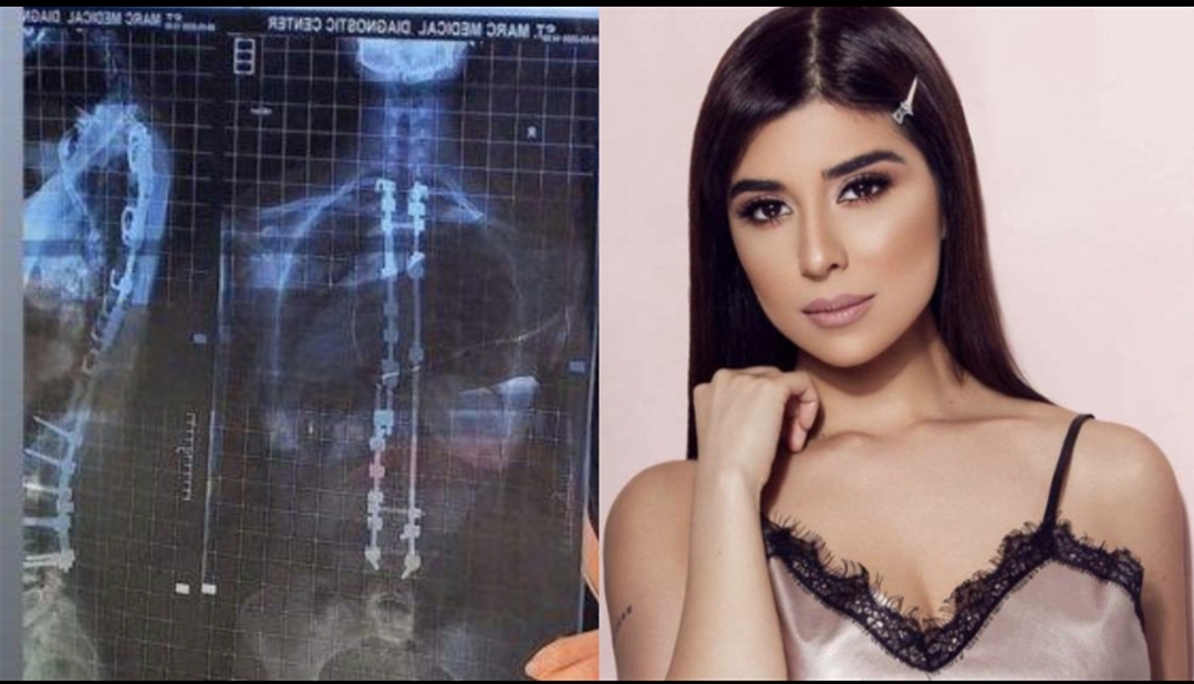 Photo of زينة مكي تستعيد ذكريات علاجها: أصبحت امرأة حديدية