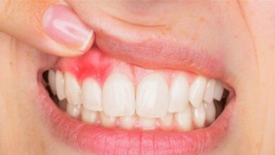 Photo of هل تعانون من التهابات الفم؟… اليكم هذه المعلومات