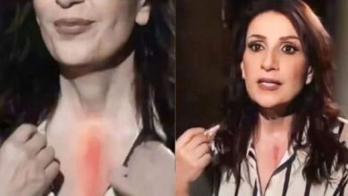 Photo of بالفيديو- نجمة باب الحارة  تتحدث لأول مرة عن خضوعها لـ عملية خطيرة وتكشف عن جرحها الكبير