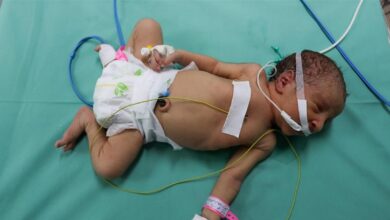 Photo of في غزة.. صحافي قام بتوليد سيدة بعد أن استعان هاتفياً بطبيب!